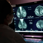 Mamografía y RMN de Mama ($ARS)